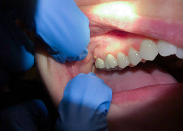 Best Broken or Chipped Tooth Repair in Lambertville, MI