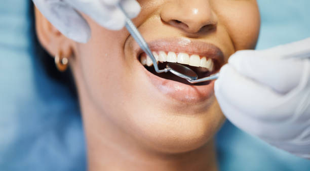 Best Walk-In Emergency Dental Services in Lambertville, MI
