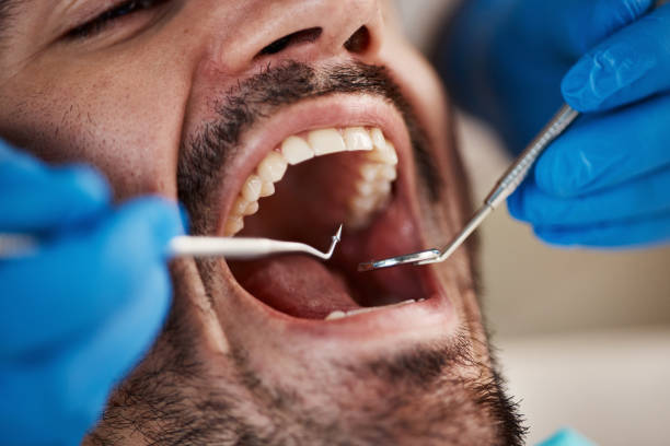 Best Dental Abscess Treatment in Lambertville, MI